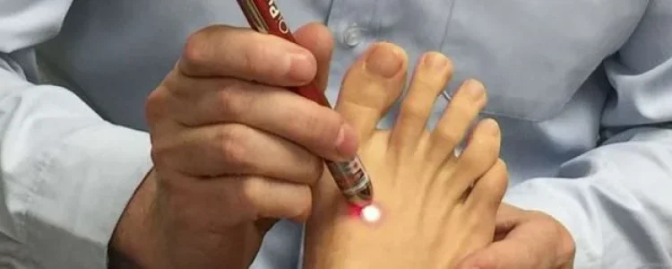 Laser-Acupuncture-Orlando