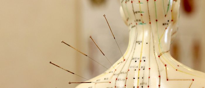 acupunctuur2