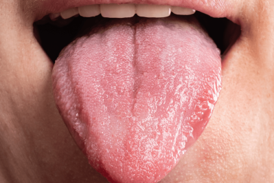 tongue-diagnosis-chart