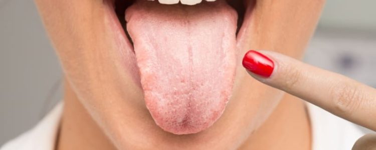 tongue-indicate-health-problems