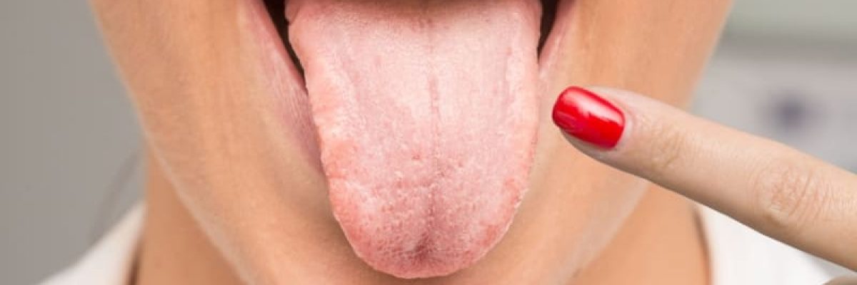 tongue-indicate-health-problems