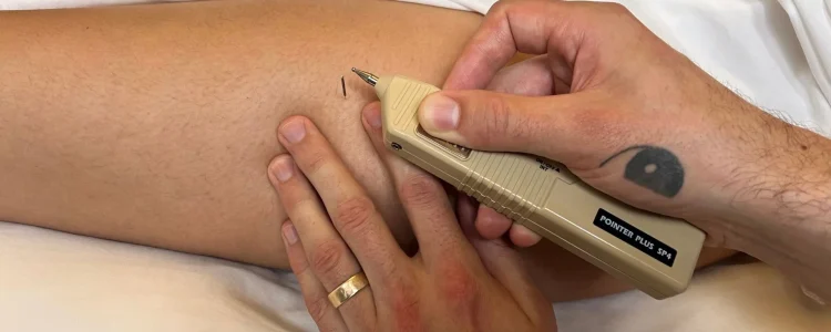 vancouver-sports-acupuncture